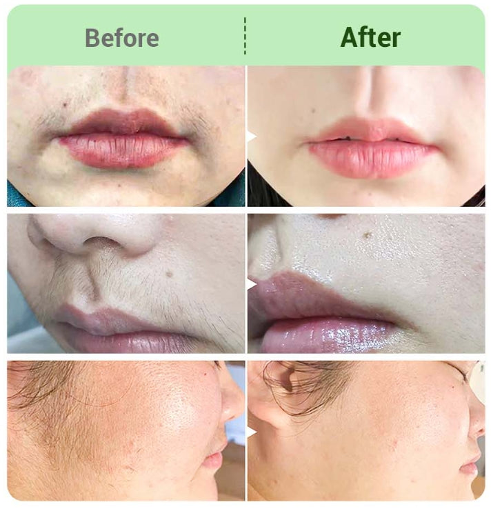💖Hair Removal Cream Kit for Women💛