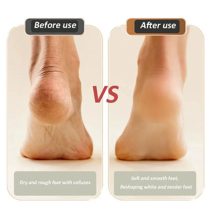 2024 New USB Rechargeable Foot Repair And Grinding Device
