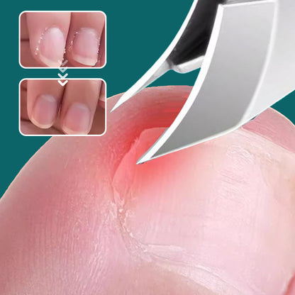 🔥2026 Hot Sale🔥Anti-Splash 25° Slant Edge Nail Clipper 3-Piece Set
