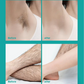 🔥Painless Full Body Hair Removal Cream for Men & Women– Skin-friendly for all areas🌿⏳Limited time 50% off⏳