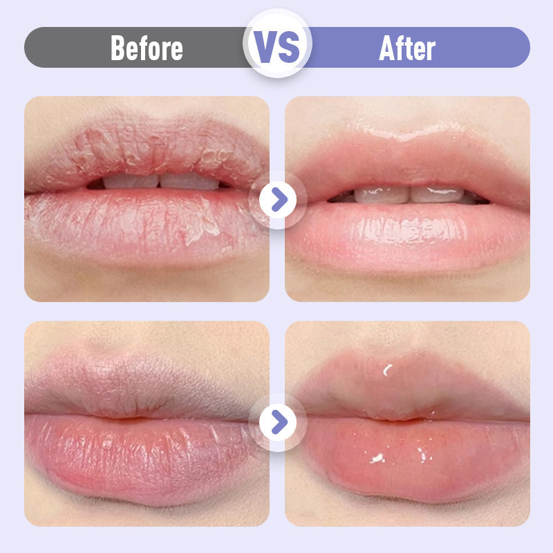 Soothe Dry, Chapped Lips Instantly | Intensive Nourishing Lip Care Balm