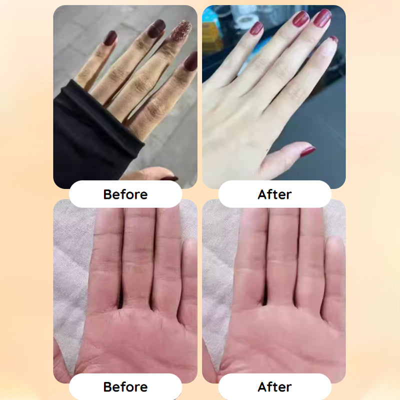🥳2026 HOT SALE💞50K+ SOLD🌸Fresh Hydrating Hand Cream – Instant relief for dry hands! Deep moisture that lasts, leaving skin soft & supple all day🌿🤲