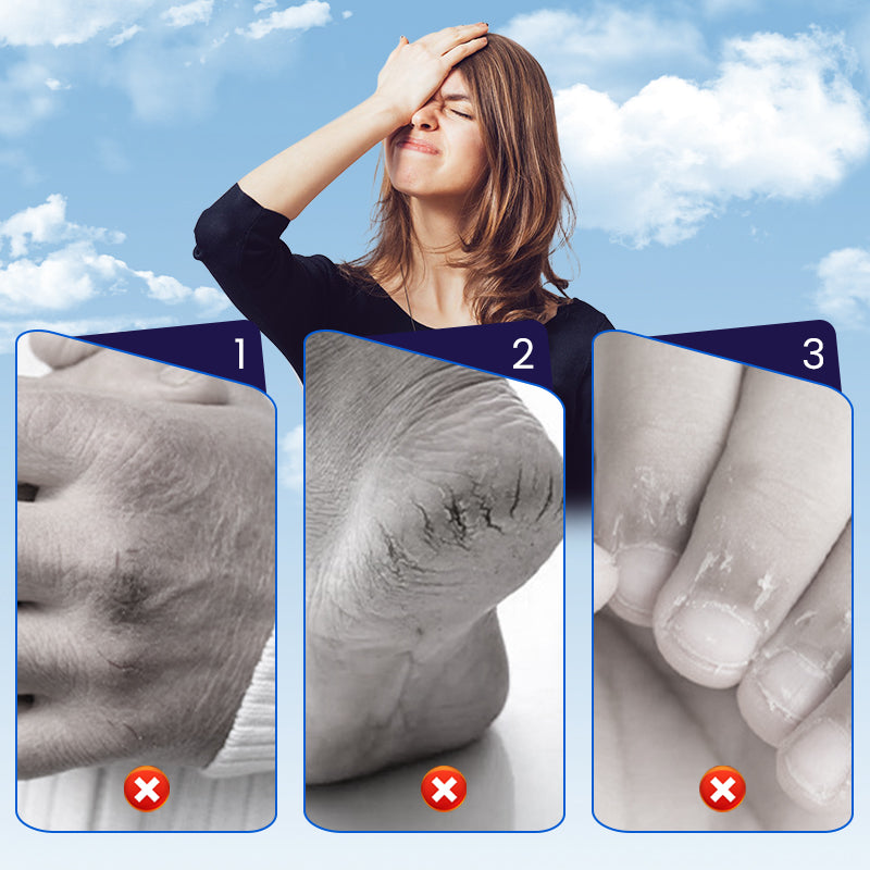 Cracked Skin Repair Patch for Hands & Feet