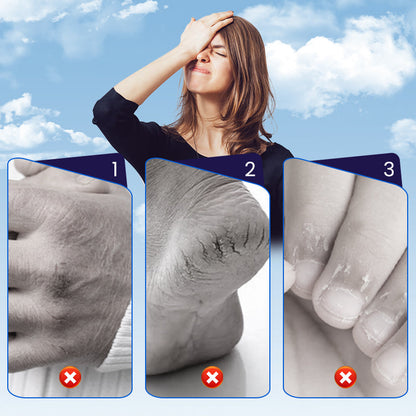 Cracked Skin Repair Patch for Hands & Feet
