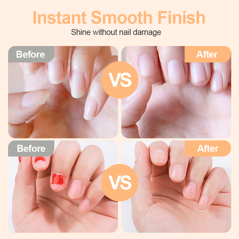 🎉 2026 Sale — Over 29,000 Sold! 💅 2-in-1 Electric Nail Clipper｜Safe Trimming & Polishing for Baby, Kids & Seniors ✨